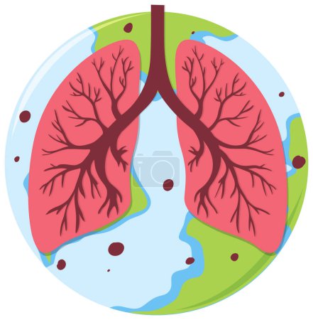 Illustration for Lungs on globe in flat style illustration - Royalty Free Image