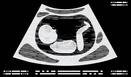 Téléchargez les illustrations : Ultrasound picture of fetus illustration - en licence libre de droit
