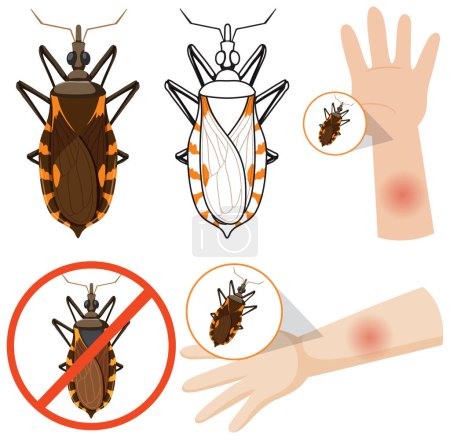 Téléchargez les illustrations : Human arm swollen from kissing bug bite illustration - en licence libre de droit