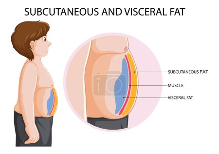 Diagrama de grasa subcutánea y visceral ilustración