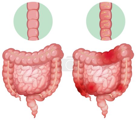 Illustration for Human internal organ small and large intestine illustration - Royalty Free Image