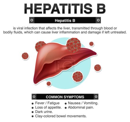 Symptoms of Hepatitis B Infographic illustration