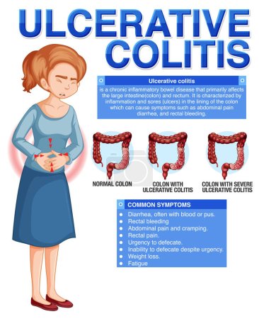 Illustration for Ulcerative Colitis Symptoms Infographic illustration - Royalty Free Image