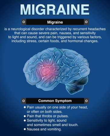 Ilustración de Cartel informativo de Ilustración de migraña - Imagen libre de derechos