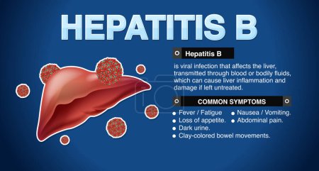 Ilustración de Síntomas de la hepatitis B Ilustración infográfica - Imagen libre de derechos