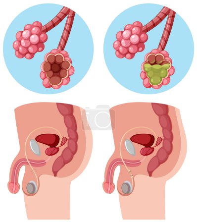 Ilustración de Ilustración vectorial del sistema reproductor masculino y femenino - Imagen libre de derechos