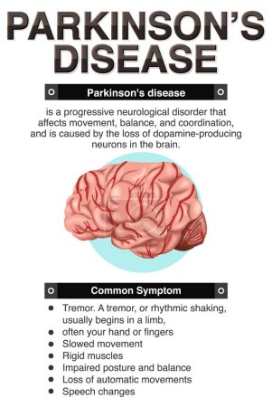 Informatives Plakat zur Illustration der Parkinson-Krankheit