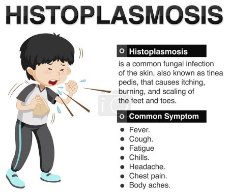 Illustration for Informative poster of Histoplasmosis illustration - Royalty Free Image