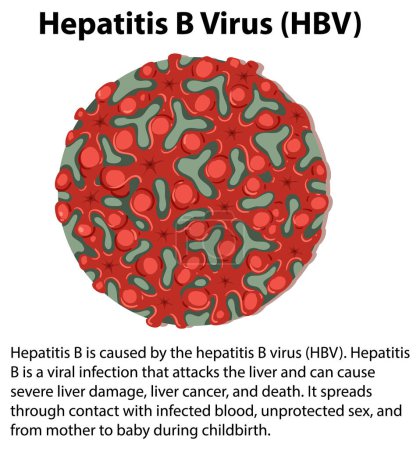 Illustration for Hepatitis B Virus (HBV) with explanation illustration - Royalty Free Image