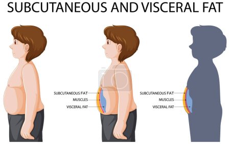 Illustration for Subcutaneous and visceral fat diagram illustration - Royalty Free Image