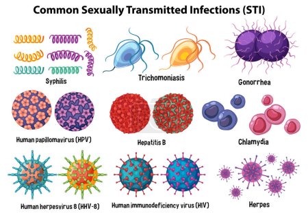 Ilustración de Infecciones de transmisión sexual (ITS) comunes ilustración - Imagen libre de derechos