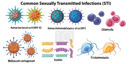 Téléchargez les illustrations : Illustration des infections transmissibles sexuellement (ITS) courantes - en licence libre de droit
