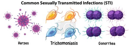 Ilustración de Infecciones de transmisión sexual (ITS) comunes ilustración - Imagen libre de derechos
