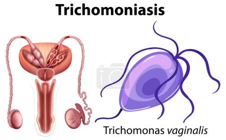 Trichomonas vaginalis on white background illustration