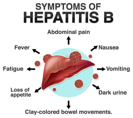 Illustration for Informative symptoms of Hepatitis B illustration - Royalty Free Image