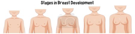 Illustration for Stages in Breast Development illustration - Royalty Free Image