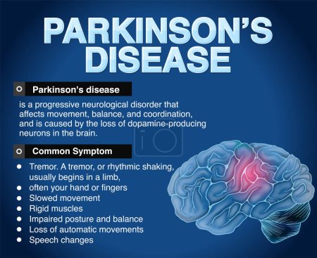 Informatives Plakat zur Illustration der Parkinson-Krankheit