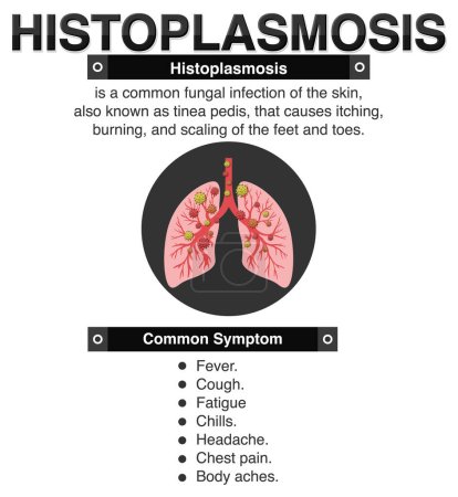 Illustration for Informative poster of Histoplasmosis illustration - Royalty Free Image