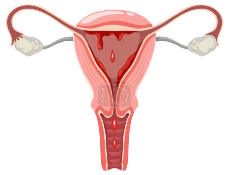 El útero y los ovarios con ilustración de sangre