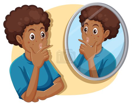 Illustration for Teenage Boy with Acne Troubles illustration - Royalty Free Image