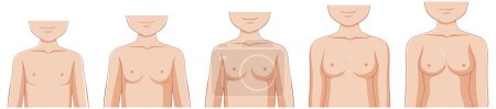 Illustration for Breast Development Stages of Puberty Girl illustration - Royalty Free Image