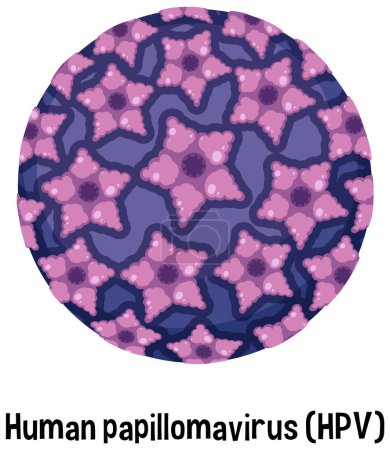 Ilustración de Virus del papiloma humano (VPH) con ilustración de texto - Imagen libre de derechos