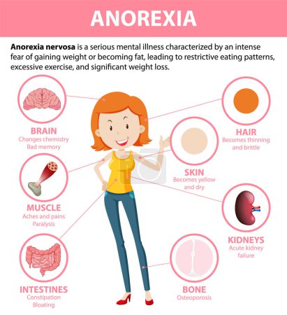 Illustration for Illustration depicting the impact of Anorexia on various body functions - Royalty Free Image
