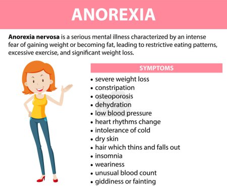 Ilustración de Cartel ilustrado que explica los síntomas del trastorno alimentario de la anorexia en mujeres - Imagen libre de derechos