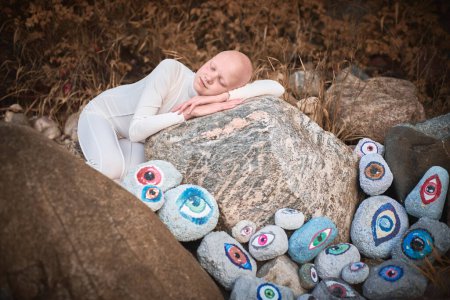 Young hairless girl with alopecia in white futuristic costume sleeping sweetly in surreal landscape with many eyes stones, blurring lines between reality and imagination