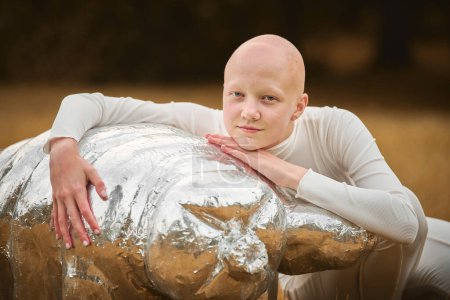 Photo for Portrait of young hairless girl with alopecia in white cloth hugging figure of tardigrade in autumn park background, bald pretty teenage girl highlighting beauty found in embracing vulnerability - Royalty Free Image
