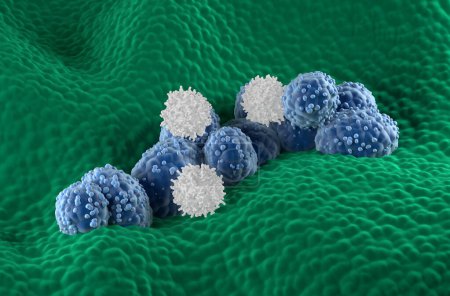 Téléchargez les photos : Les lymphocytes T attaquent les cellules cancéreuses de la prostate dans l'épithélium glandulaire prostatique - vue isométrique Illustration 3d - en image libre de droit