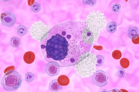 Foto de Las células T atacan células de mieloma múltiple en el flujo sanguíneo - vista de cerca ilustración 3d - Imagen libre de derechos