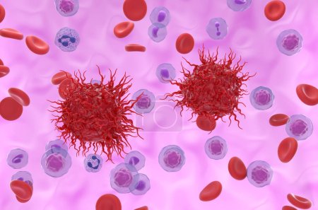 Foto de Células tumorales neuroendocrinas metastásicas en el flujo sanguíneo - Ilustración 3d vista isométrica - Imagen libre de derechos