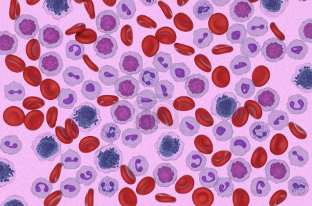 Células de leucemia mieloide aguda (LMA) en el flujo sanguíneo - vista microscópica ilustración 3D
