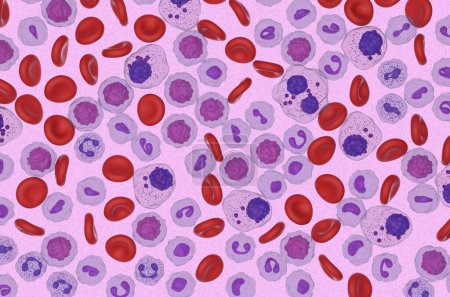 Foto de Mieloma múltiple (MM) células en el flujo sanguíneo - vista microscópica 3d ilustración - Imagen libre de derechos
