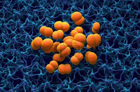 Foto de Neisseria meningitidis (meningococo) bacterias en el cerebro (infección por meningitis) - vista isométrica ilustración 3d - Imagen libre de derechos