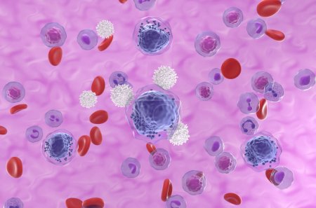 Téléchargez les photos : Les lymphocytes T attaquent les cellules atteintes de leucémie myéloïde aiguë (LMA) dans le flux sanguin - vue isométrique Illustration 3d - en image libre de droit