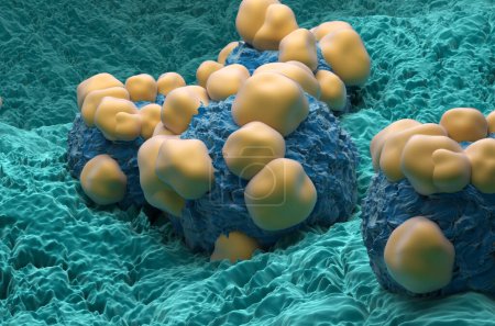 Téléchargez les photos : Adénocarcinome cellules cancéreuses dans le corps humain - vue rapprochée illustration 3d - en image libre de droit
