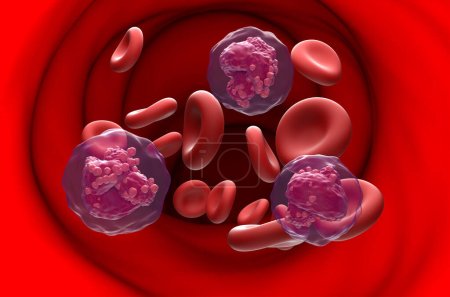 Téléchargez les photos : Cellule cancéreuse aiguë de leucémie lymphoblastique (LAL) dans le flux sanguin - vue de section Illustration 3d - en image libre de droit