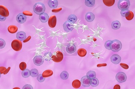 Téléchargez les photos : Thrombocythémie essentielle (ET), un cancer du sang par surproduction de plaquettes (thrombocytes) - vue isométrique Illustration 3d - en image libre de droit
