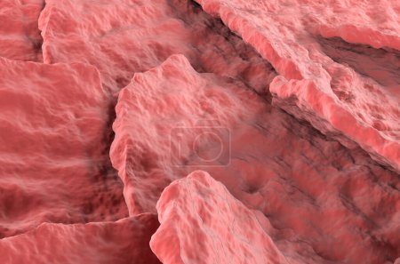 Foto de Psoriasis superficie de la piel - vista de cerca 3d ilustración - Imagen libre de derechos