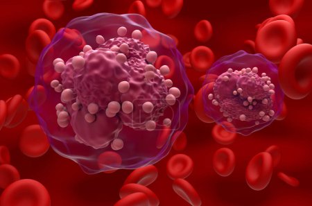 Téléchargez les photos : Leucémie lymphoblastique aiguë (LAL) cellules cancéreuses dans le flux sanguin - vue rapprochée Illustration 3d - en image libre de droit