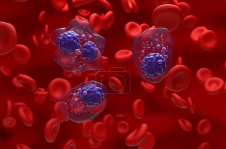 Téléchargez les photos : Grappe de cellules myélomateuses multiples dans le flux sanguin - vue isométrique Illustration 3D - en image libre de droit