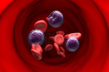 Photo for Non-hodgkin lymphoma NHL cells in the blood flow - section view 3d illustration - Royalty Free Image