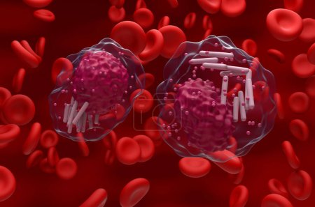 Foto de Células de leucemia linfocítica crónica (LLC) en el flujo sanguíneo - vista de cerca ilustración 3d - Imagen libre de derechos