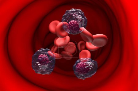 Foto de Células de leucemia linfocítica crónica (LLC) en el flujo sanguíneo - ver ilustración en 3D - Imagen libre de derechos