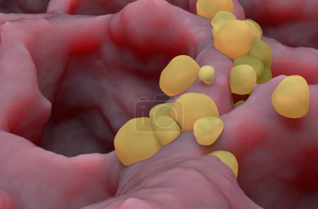 Téléchargez les photos : Small cancer tumors on the lung tissue: lung cancer (LC) - closeup view 3d illustration - en image libre de droit