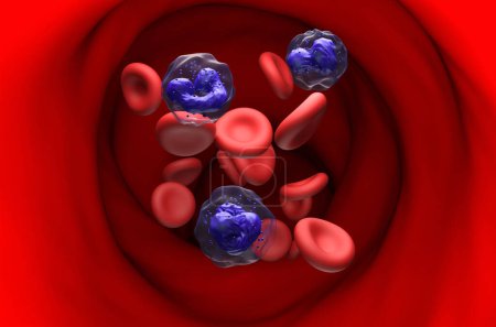 Foto de Células de leucemia mielógena crónica (LMC) en el flujo sanguíneo - ver ilustración en 3D - Imagen libre de derechos