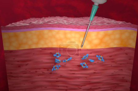 Photo for Monoclonal antibody treatment (Adalimumab) - isometric view 3d illustration - Royalty Free Image