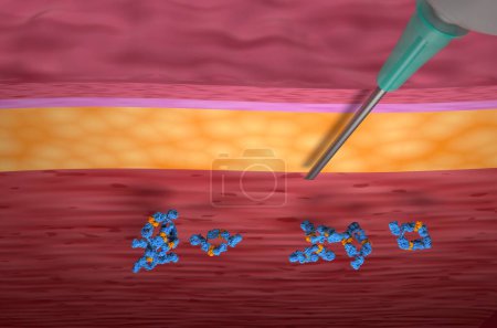 Photo for Monoclonal antibody treatment (Adalimumab) - top view 3d illustration - Royalty Free Image